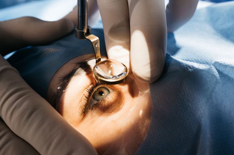Cataract Evaluations in Goshen, NY